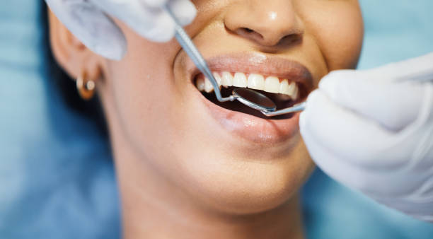 Best Emergency Gum Treatment in Bexley, OH