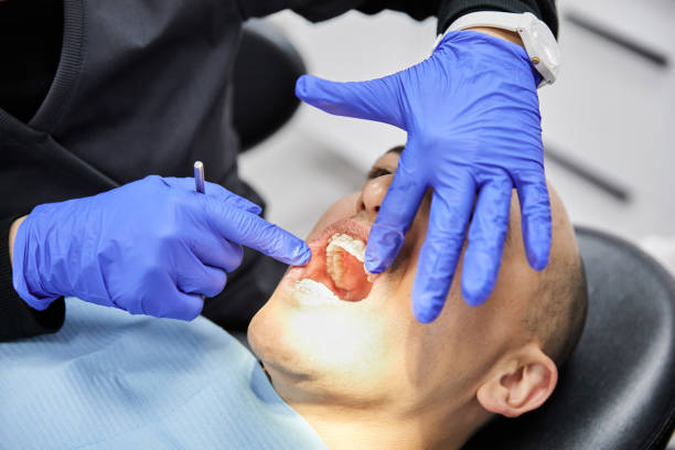Best Emergency Treatment for Dental Infections or Abscesses in Bexley, OH